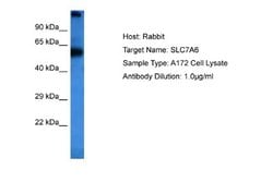 SLC7A6 Rabbit anti-Human, Polyclonal, Novus Biologicals 0.1ml; Unconjugated:Antibodies,